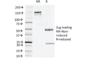 Image no. 1 for anti-Thymidine Phosphorylase (TYMP) antibody (ABIN6939276)