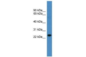 WB Suggested Anti-RAB9B Antibody Titration: 0.