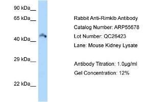 Image no. 1 for anti-Ribosomal Modification Protein RimK-Like Family Member B (RIMKLB) (Middle Region) antibody (ABIN2786316)