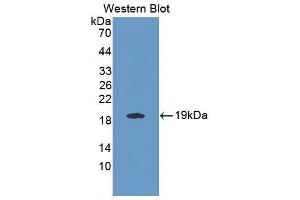 Image no. 1 for anti-Interleukin 25 (IL25) (AA 33-169) antibody (ABIN1868646)
