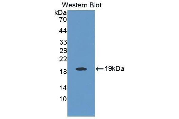 IL-25 antibody  (AA 33-169)