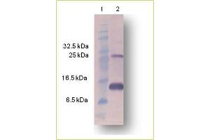 Image no. 1 for anti-Activin A (ACVA) antibody (ABIN573801)