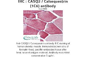 Image no. 1 for anti-Calsequestrin 2 (CASQ2) (AA 20-400), (full length) antibody (ABIN1723817)