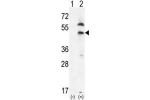 Image no. 4 for anti-Platelet-Derived Growth Factor Receptor-Like (PDGFRL) (AA 328-357) antibody (ABIN3032250)