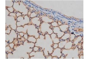 Image no. 1 for anti-Insulin-Like Growth Factor 1 Receptor (IGF1R) (pTyr1161) antibody (ABIN6256620)