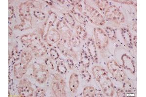 Image no. 2 for anti-Thymocyte Selection Associated (THEMIS) (AA 301-400) antibody (ABIN1714633)