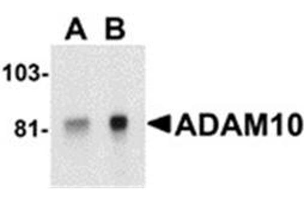 anti-ADAM Metallopeptidase Domain 10 (ADAM10) (AA 732-748) antibody