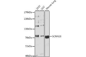 Western blot analysis of extracts of various cell lines, using SCNN1B antibody (ABIN3022509, ABIN3022510, ABIN1513502 and ABIN6218866) at 1:3000 dilution.