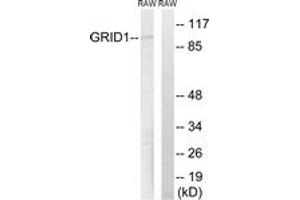 Image no. 1 for anti-Glutamate Receptor, Ionotropic, delta 1 (GRID1) (AA 831-880) antibody (ABIN1534412)
