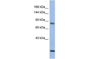 Image no. 2 for anti-Mitogen-Activated Protein Kinase Kinase Kinase 11 (MAP3K11) (Middle Region) antibody (ABIN2786655)