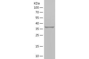 STOML2 Protein (AA 253-356) (IF2DI tag)