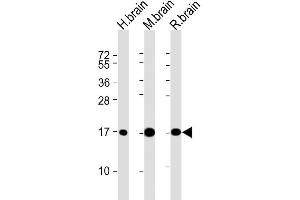 Image no. 3 for anti-Microtubule-Associated Protein 1 Light Chain 3 alpha (MAP1LC3A) antibody (ABIN387792)