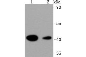 Image no. 1 for anti-Histone Deacetylase 8 (HDAC8) antibody (ABIN5557483)