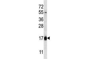 Image no. 3 for anti-Hemoglobin theta 1 (HBQ1) (AA 1-28) antibody (ABIN3031178)