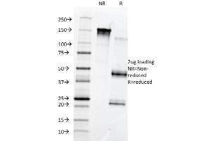 Image no. 1 for anti-Fibronectin 1 (FN1) antibody (ABIN6939413)