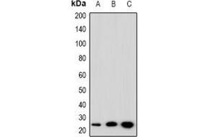 Image no. 2 for anti-SFT2 Domain Containing 3 (SFT2D3) antibody (ABIN3222795)