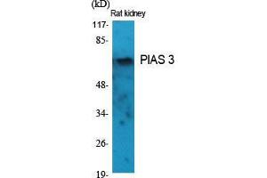 Image no. 2 for anti-Protein Inhibitor of Activated STAT, 3 (PIAS3) (N-Term) antibody (ABIN3186437)