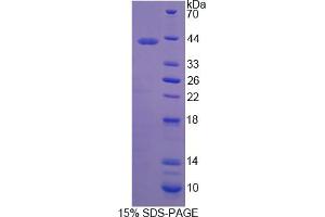 Image no. 1 for Latrophilin 3 (LPHN3) (AA 1105-1447) protein (His tag) (ABIN6236637)