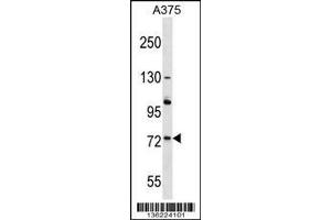 Western Blotting (WB) image for anti-Acyl-CoA Oxidase 2, Branched Chain (Acox2) (N-Term) antibody (ABIN2158890)