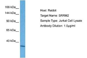 Image no. 2 for anti-Serine/arginine Repetitive Matrix 2 (SRRM2) (C-Term) antibody (ABIN2777758)