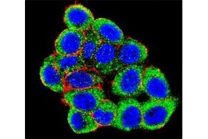 Image no. 1 for anti-Promyelocytic Leukemia (PML) (AA 470-499), (Sumoylation Site) antibody (ABIN3032330)
