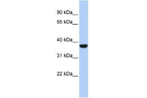 Image no. 1 for anti-Exosome Component 2 (EXOSC2) (Middle Region) antibody (ABIN2779056)