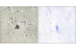 Immunohistochemistry analysis of paraffin-embedded human brain, using PLC beta3 (Phospho-Ser537) Antibody.