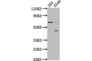 CRTAC1 Antikörper  (AA 309-661)
