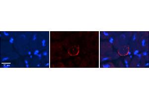 Image no. 2 for anti-Sodium Channel, Voltage-Gated, Type VIII, alpha (SCN8A) (C-Term) antibody (ABIN2776200)