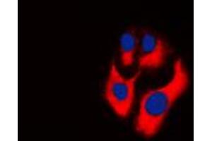 Image no. 1 for anti-Creatine Kinase, Mitochondrial 2 (Sarcomeric) (CKMT2) (Center) antibody (ABIN2705889)