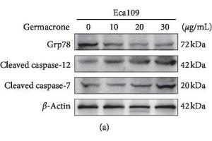 Image no. 2 for anti-Caspase 7, Apoptosis-Related Cysteine Peptidase (CASP7) (Center) antibody (ABIN2855362)