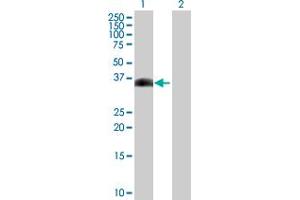 Image no. 1 for anti-Small Nuclear RNA Activating Complex, Polypeptide 3, 50kDa (SNAPC3) (AA 1-253) antibody (ABIN520333)