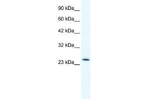 Image no. 1 for anti-Transcription Factor 7 (T-Cell Specific, HMG-Box) (TCF7) (N-Term) antibody (ABIN2776020)
