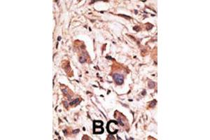 Image no. 2 for anti-Melanoma Antigen Family D, 1 (MAGED1) (Center) antibody (ABIN2445251)
