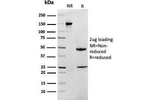 Image no. 4 for anti-Methylthioadenosine phosphorylase (MTAP) (AA 97-196) antibody (ABIN6940087)