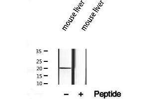 Image no. 2 for anti-Translocase of Inner Mitochondrial Membrane 17 Homolog B (TIMM17B) (Internal Region) antibody (ABIN6265575)