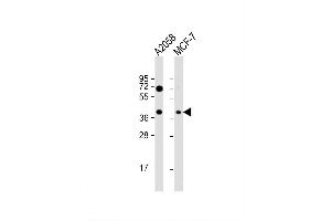 Image no. 2 for anti-Guanine Nucleotide Binding Protein (G Protein) alpha 12 (GNA12) (AA 46-75) antibody (ABIN392591)