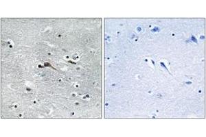 Image no. 2 for anti-Cytokine-Like 1 (CYTL1) (AA 61-110) antibody (ABIN1534403)