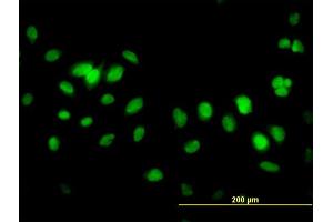 Immunofluorescence of monoclonal antibody to FBXL10 on HeLa cell.