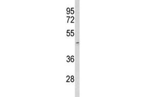 Image no. 1 for anti-Acrosin (ACR) (AA 99-127) antibody (ABIN5647947)