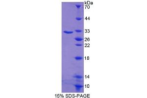 Image no. 1 for C-terminal Binding Protein 1 (CTBP1) (AA 1-250) protein (His tag) (ABIN6238970)