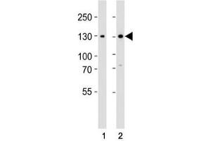 Western blot analysis of lysate from (1) 293 and (2) Jurkat cell line using GLI2 antibody at 1:1000.