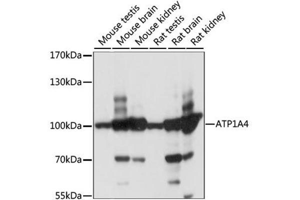 ATP1A4 antibody