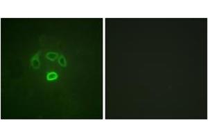 Immunofluorescence analysis of HepG2 cells, using GRB10 (Phospho-Tyr67) Antibody.