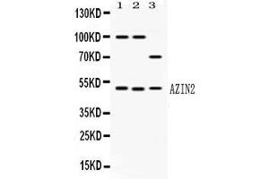 Image no. 1 for anti-Arginine Decarboxylase (ADC) (AA 111-301) antibody (ABIN4886479)
