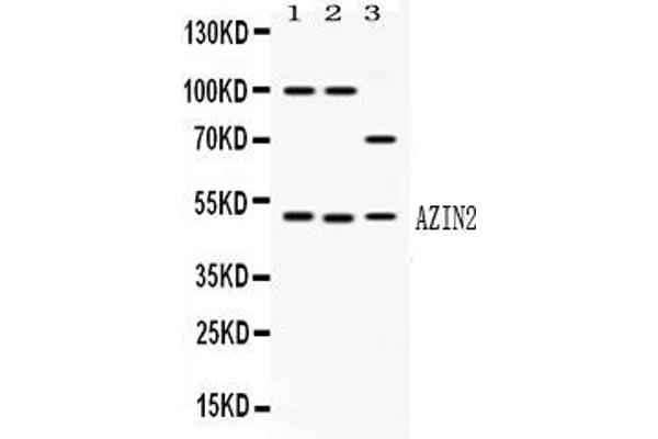 anti-Arginine Decarboxylase (ADC) (AA 111-301) antibody