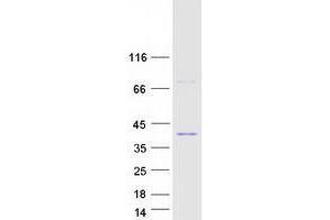 Image no. 1 for Upstream Transcription Factor 1 (USF1) (Transcript Variant 2) protein (Myc-DYKDDDDK Tag) (ABIN2735079)