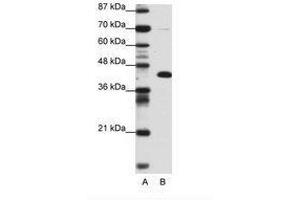 Image no. 1 for anti-Zinc Finger and BTB Domain Containing 25 (ZBTB25) (AA 181-230) antibody (ABIN6736153)