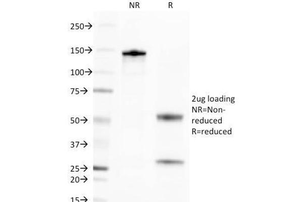 anti-Tumor Necrosis Factor Receptor Superfamily, Member 17 (TNFRSF17) (AA 78-184) antibody