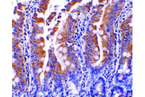 Image no. 3 for anti-Golgi-Associated PDZ and Coiled-Coil Motif Containing (GOPC) (C-Term) antibody (ABIN6657012)